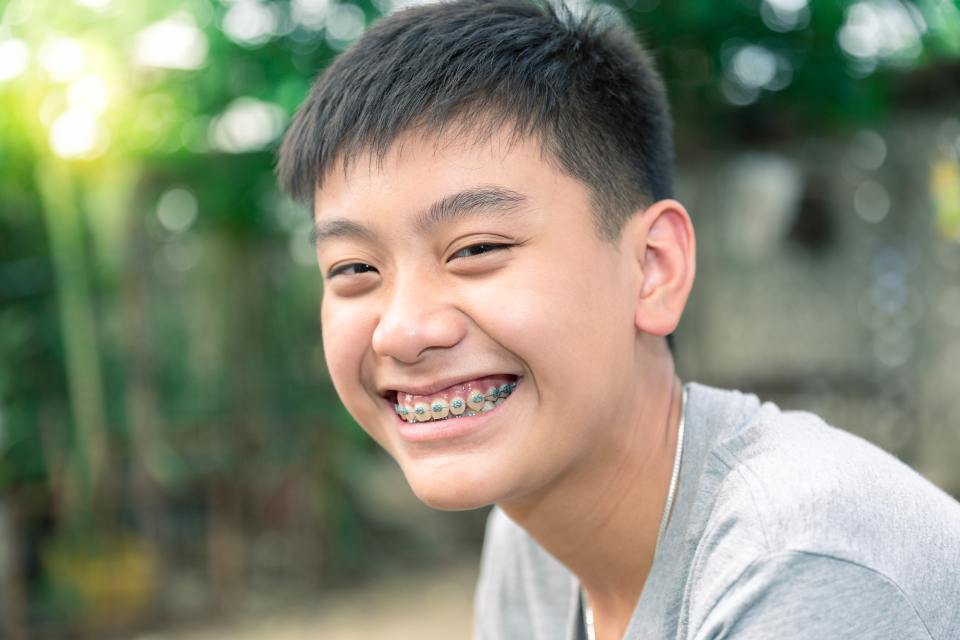 Traditional (Metal) Braces Traditional (Metal) Braces