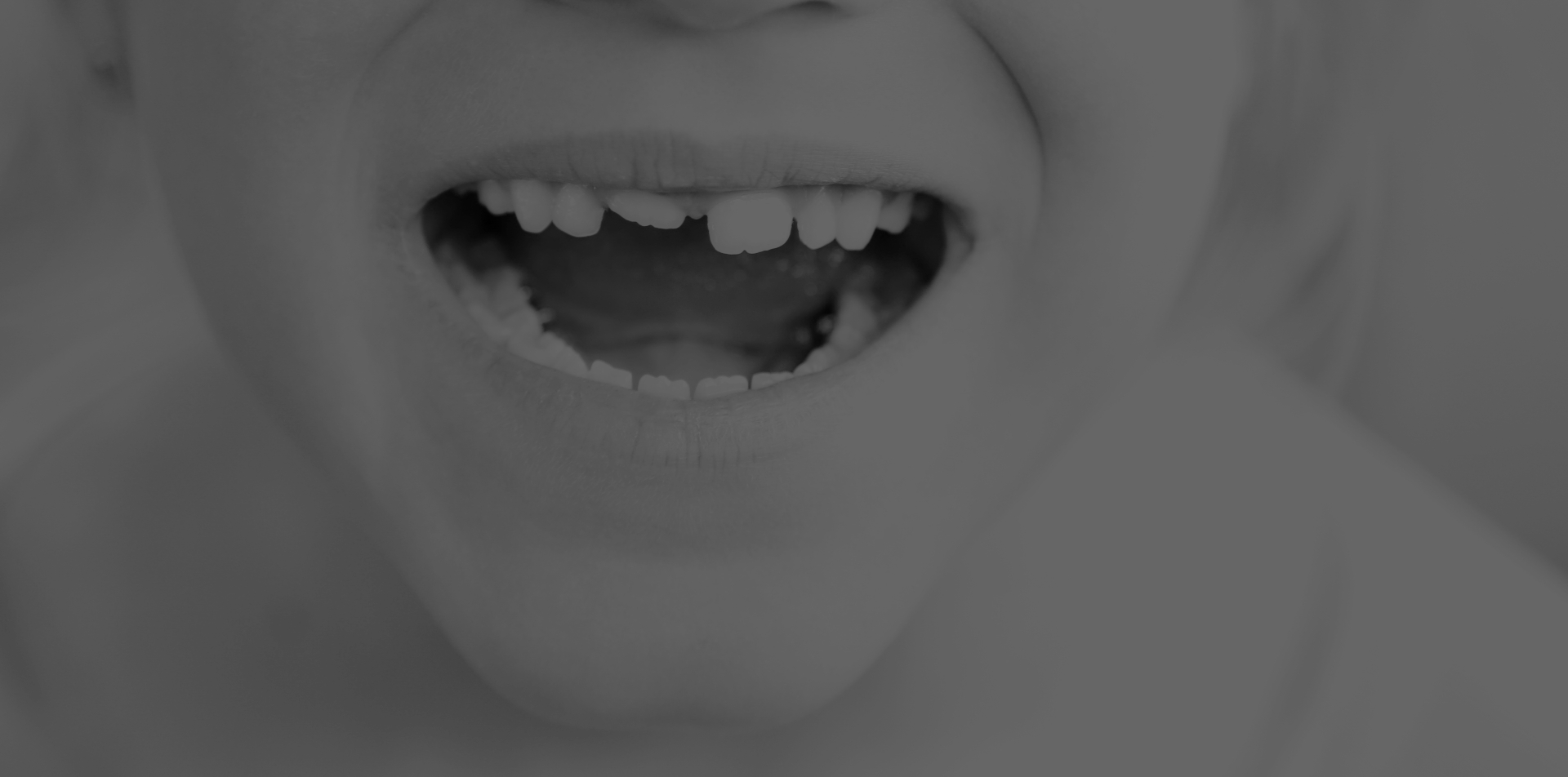 Orthodontic Problems Common Issues For Children, Teenagers & Adults