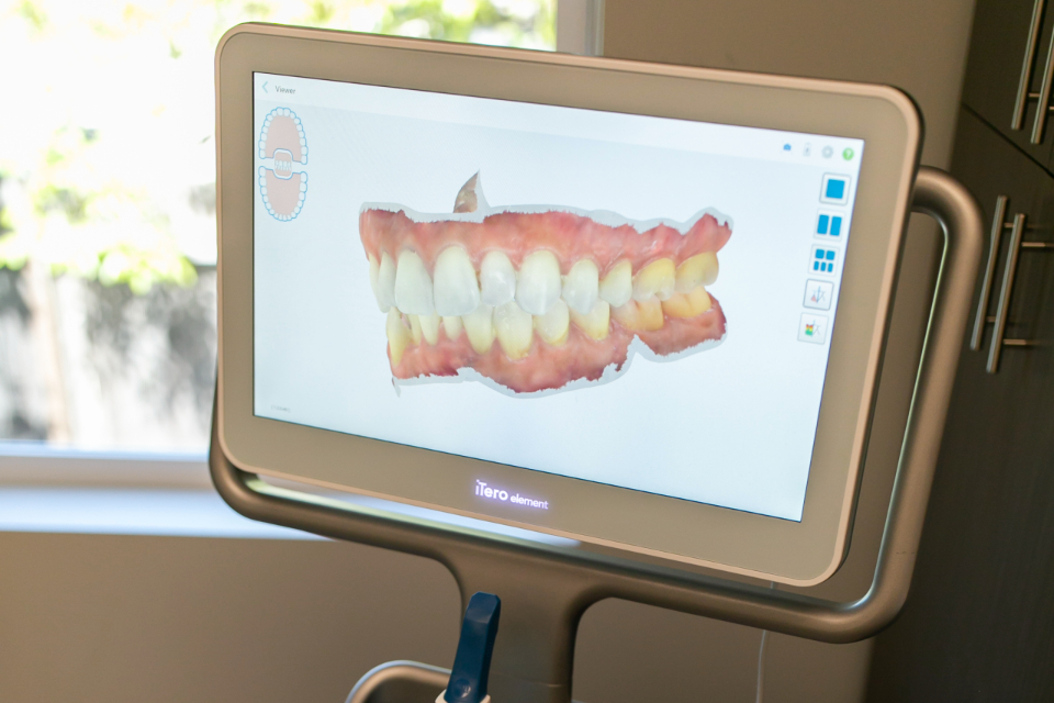 Orthodontic Technologies